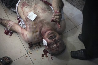 Syria Is Obama's Greatest Failure