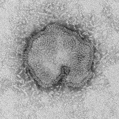 Why a Saudi Virus Is Spreading Alarm