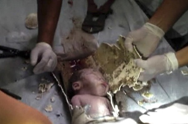 Not Just Newborns Abandoned in China