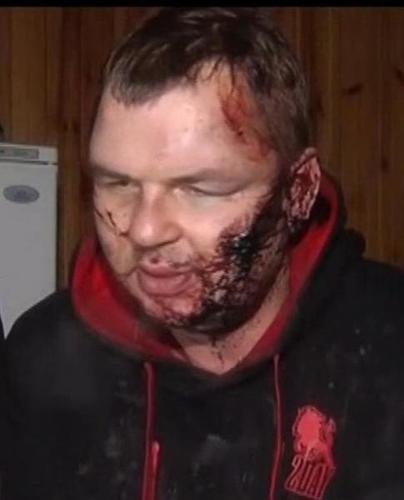 Ukraine's Renewed Offensive in East