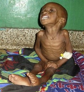Somalia's Drought a U.S. Problem