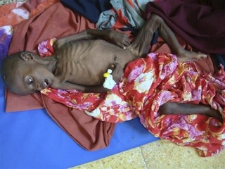We Cannot Let Somalia Starve