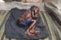 Measles Hits Ethiopian Refugee Camp